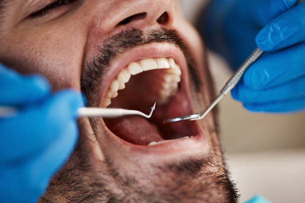 Best Emergency Denture Repair in Granbury, TX